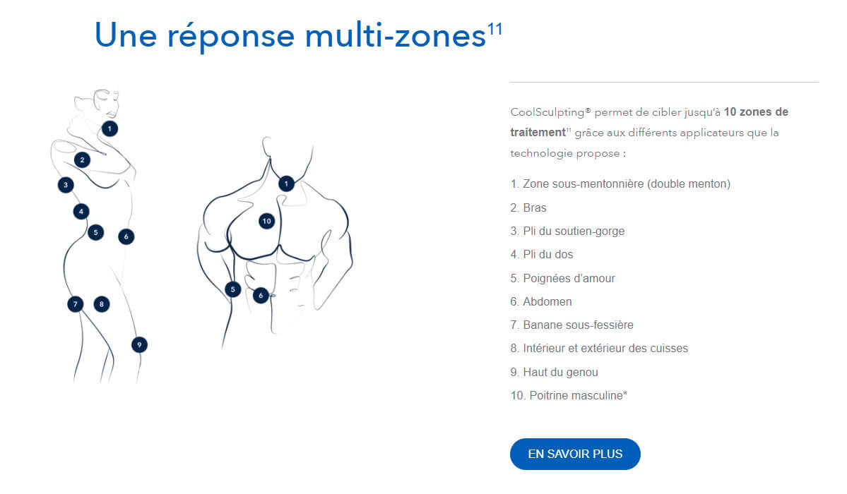 coolsculpting zones